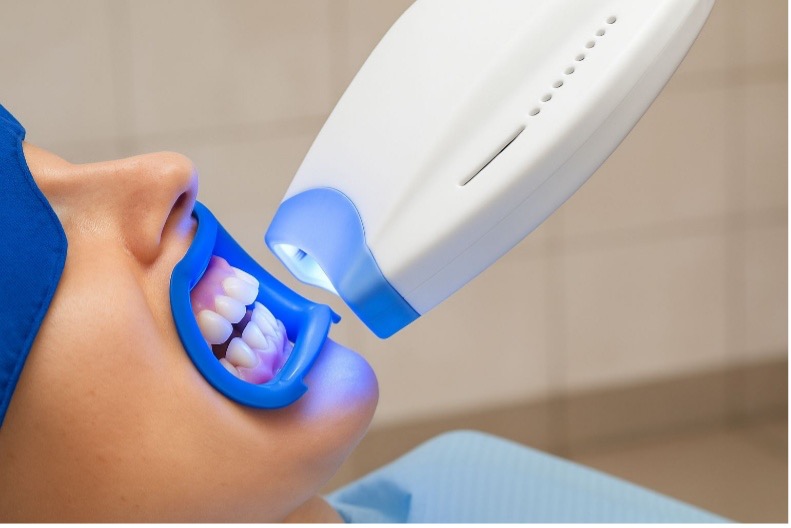 Teeth Whitening